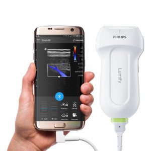 Philips Lumify - pierwsza na rynku głowica USG z aplikacją mobilną już dostępna w Polsce 5 lumify 1